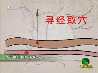 艾灸--中华医药传统疗法 中华医药艾灸视频