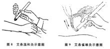 灸法 灸法和针刺有什么区别