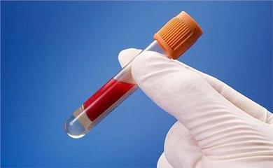 红细胞压积（Hct）对血糖测量的影响 hct红细胞压积偏低