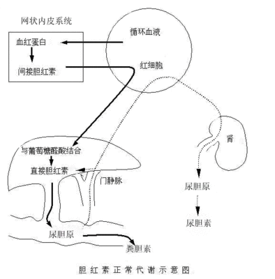 胆红素升高一定是病吗？ 间接胆红素升高