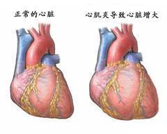 病毒性心肌炎是由什么原因引起的？ 病毒性心肌炎吃什么药