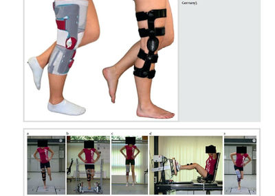 膝盖韧带拉伤如何治疗 韧带拉伤怎么办恢复快