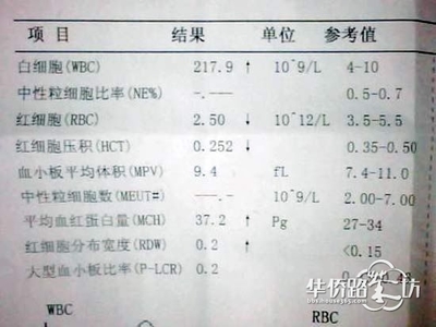 如何看懂检验单 如何看懂血常规报告单