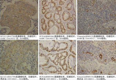 免疫组化方法中关键环节及其原理解述 免疫组化abc法原理