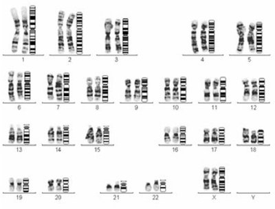 染色体核型分析（G显带）、荧光原位杂交（FISH）和基因检查（PCR fish结果和核型结果
