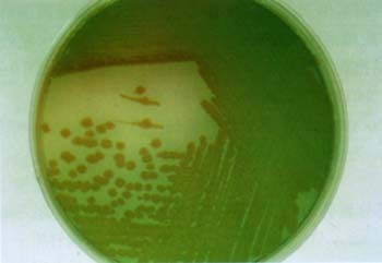 铜绿假单胞菌感染 铜绿假单胞菌感染症状