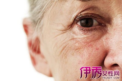 皮肤与细胞老化的原因 皮肤老化的原因