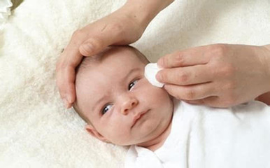 新生儿泪腺管堵塞（眼屎多、黄）护理 婴儿泪腺堵塞症状