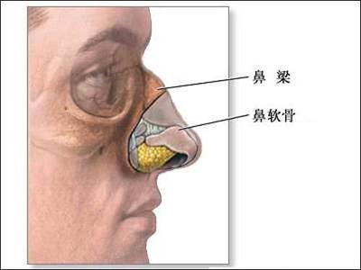 鼻子整形手术安全吗？ 安全鼻子整形手术