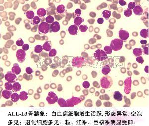 猫白血病病毒（FeLV） t淋巴细胞白血病病毒