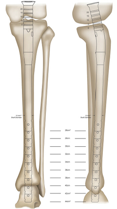 胫骨前肌的解剖 胫骨解剖