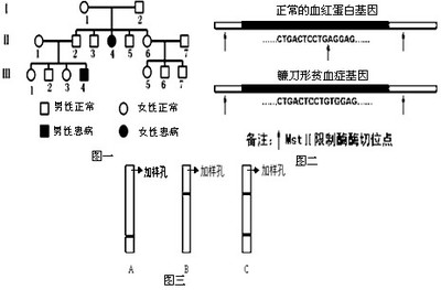 非洲疟疾和镰刀型细胞贫血症 镰刀状细胞贫血症