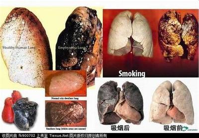 一个长期吸烟者的肺... 吸烟者的肺多久能恢复