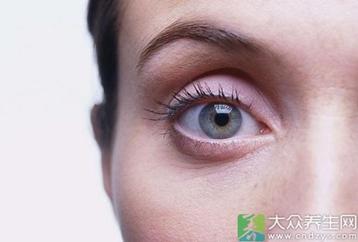 眼睛有飞蚊症怎么治疗? 眼睛飞蚊症原因及治疗