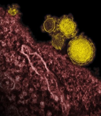 新冠状病毒比萨斯病毒更可怕 小狗 冠状病毒