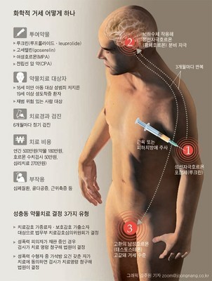 韩国对性犯实施化学阉割 化学方法犯罪