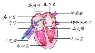 房颤射频消融术后感觉及联想 房颤射频消融术ppt