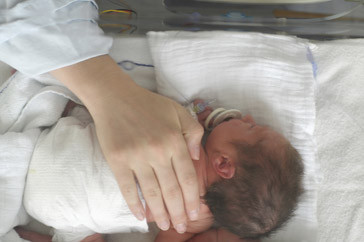 谈谈“母乳性黄疸” 新生儿母乳性黄疸