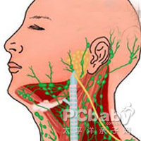 耳后淋巴结肿大的原因与治疗 耳后淋巴结肿大原因