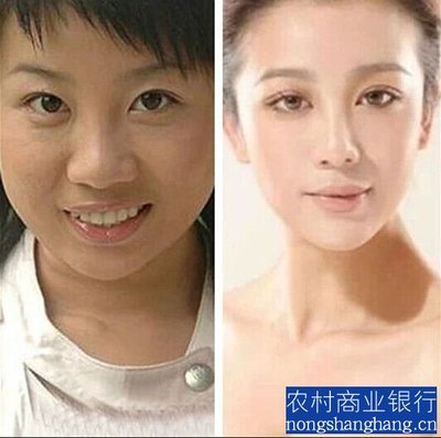 阿宝老婆张冬玲个人资料近照张冬玲整容前后对比照 张冬玲和阿宝结婚照