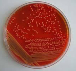 大肠杆菌菌落形态.... 大肠杆菌菌落颜色
