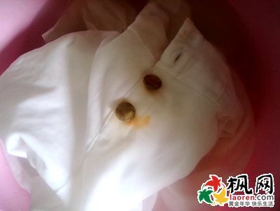 衣服上的铁锈怎么洗 衣服上面的铁锈怎么洗