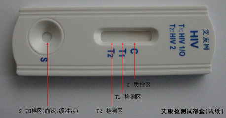 艾滋病检测试纸使用方法 艾滋病怎么检查