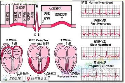 心电图怎么看,心电图讲解,心电图t波改变 心电图显示t波改变