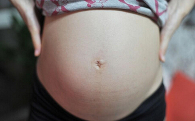 产后妊娠纹怎么消除，怎样去除妊娠纹？ 产后妊娠纹怎么消除
