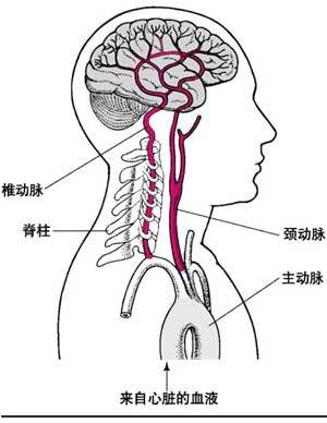 怎样识别动脉硬化的前兆 脑供血不足如何调理