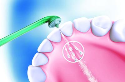 警惕洗牙的危害 洗牙后的注意事项