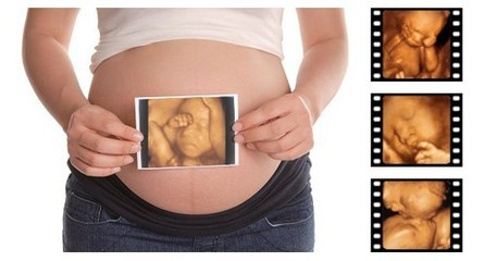 孕期什么时候做四维彩超最好？ 孕期四维彩超多少钱