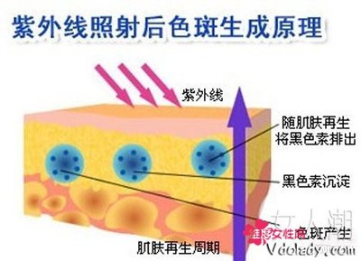 色斑是怎么形成的 色斑是怎么样形成的