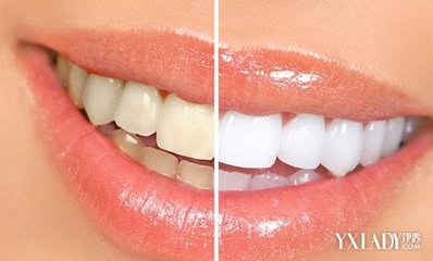 最简单有效的美白方法 牙黄变白的简单方法