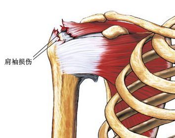 [转载]肩袖肌群与大圆肌的解剖 肩袖解剖图
