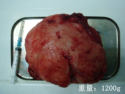 一例苏牧犬胸腹壁肌间脂肪瘤 腹部脂肪瘤