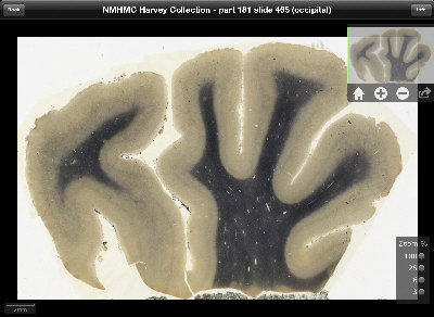 美国费城穆特博物馆独家展出爱因斯坦大脑切片曾被私自带走研究 赫穆特.庞克