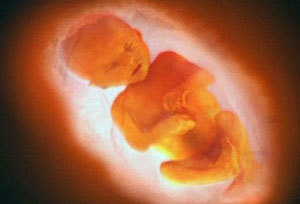 如何才能不怀孕：消灾积福之道21、22、23、 - 生儿子网 - 生男生 生男生女预测表