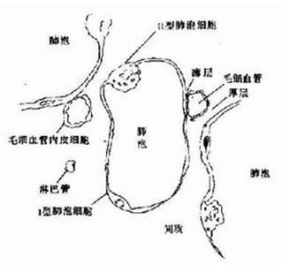 什么是双肺下叶间质性纤维化及治疗方 间质性肺炎肺纤维化