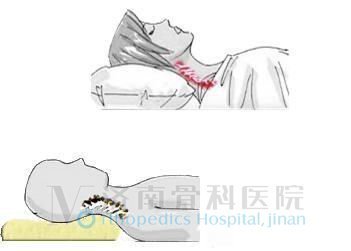 预防颈椎病的枕头如何选择？ 颈椎病如何挑选枕头