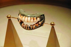 古代人用什么材料做假牙？ 假牙什么材料好