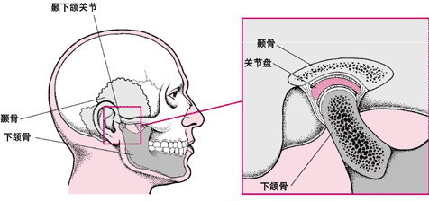 颞下颌关节紊乱综合症的病因与治疗方法 颞下颌紊乱综合症