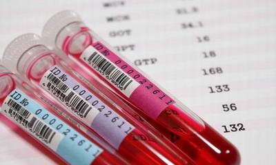 三大常规检验项目及结果解释全套 生化全套包括血常规吗
