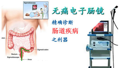 肠镜怎么做 无痛肠镜哪里做的好