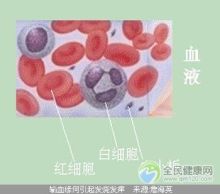 溶血反应--怀孕溶血问题 输血溶血反应