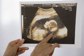 如何早知道胎儿性别 胎儿性别早知道酒精 二胎胎儿性别早知道