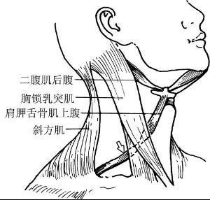 肩胛舌骨肌综合征 舌骨综合症能自愈吗