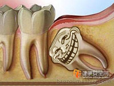 长智齿牙疼怎么办--装假牙后的饮食 智齿牙疼怎么办