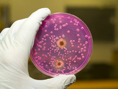 健康：如何防治男性念珠菌感染？