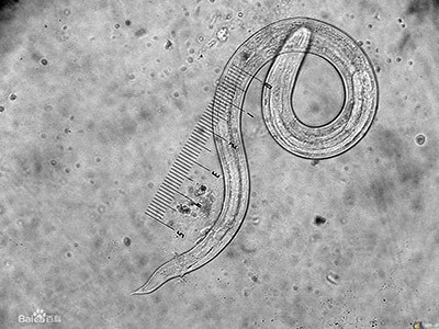 裂头蚴——可怕的寄生虫 寄生虫感染可怕吗